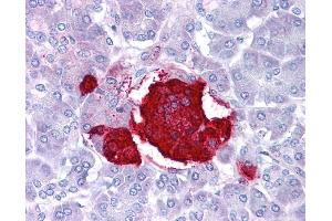 Leptin antibody was used for immunohistochemistry at a concentration of 4-8 ug/ml. (Leptin 抗体  (Middle Region))
