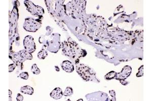 IHC testing of human placental tissue with hnRNP A1 antibody at 1ug/ml. (HNRNPA1 抗体  (AA 8-42))