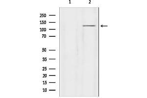 anti-Glutamate Receptor, Ionotropic, delta 2 (GRID2) (C-Term) antibody