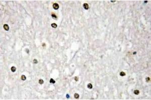 Immunohistochemistry (IHC) analyzes of p73 antibody in paraffin-embedded human brain tissue.