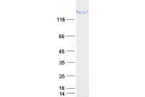 Western Blotting (WB) image for Leucine Rich Repeat (In FLII) Interacting Protein 1 (LRRFIP1) (Transcript Variant 4) protein (Myc-DYKDDDDK Tag) (ABIN2724950)