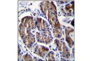 Immunohistochemistry (Paraffin-embedded Sections) (IHC (p)) image for anti-Ribosomal Protein S4, Y-Linked 1 (RPS4Y1) (AA 83-113), (Middle Region) antibody (ABIN954619)