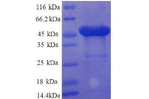 SDS-PAGE (SDS) image for Ribosomal Protein L11 (RPL11) (AA 3-178), (partial) protein (GST tag) (ABIN7479154)