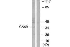 Western Blotting (WB) image for anti-Carbonic Anhydrase VB, Mitochondrial (CA5B) (C-Term) antibody (ABIN1851011) (CA5B 抗体  (C-Term))