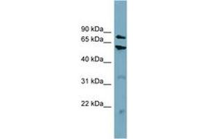 Image no. 1 for anti-Carnitine Palmitoyltransferase 1B (Muscle) (CPT1B) (AA 359-408) antibody (ABIN6743419) (CPT1B 抗体  (AA 359-408))