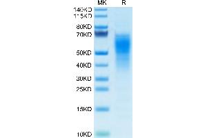 SDS-PAGE (SDS) image for Interleukin 18 Binding Protein (IL18BP) (AA 29-193) protein (His tag) (ABIN7274981)