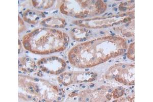 Used in DAB staining on fromalin fixed paraffin- embedded Kidney tissue (KTN1 抗体  (AA 1104-1357))