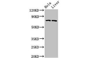 Western Blot Positive WB detected in: Hela whole cell lysate, Rat liver tissue All lanes: ACSL5 antibody at 3 μg/mL Secondary Goat polyclonal to rabbit IgG at 1/50000 dilution Predicted band size: 76, 83, 74, kDa Observed band size: 76 kDa