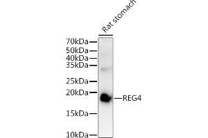 Western blot analysis of extracts of Rat stomach, using REG4 antibody (ABIN6132619, ABIN6146859, ABIN6146860 and ABIN6217007) at 1:1000 dilution. (REG4 抗体  (AA 23-158))