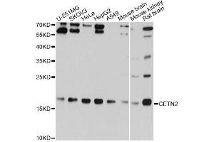 Western blot analysis of extracts of various cell lines, using CETN2 Antibody (ABIN1876585) at 1:1000 dilution. (CETN2 抗体)
