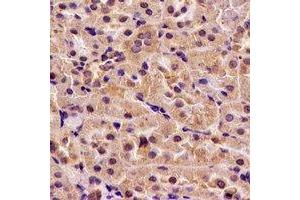 Immunohistochemical analysis of H6PD staining in rat kidney formalin fixed paraffin embedded tissue section. (Glucose-6-Phosphate Dehydrogenase 抗体)
