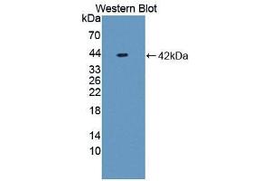 Western blot analysis of recombinant Rat NFkB. (NFkB 抗体  (AA 352-439))