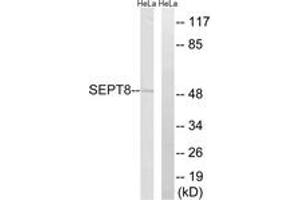 Western blot analysis of extracts from HeLa cells, using SEPT8 Antibody. (Septin 8 抗体  (AA 170-219))
