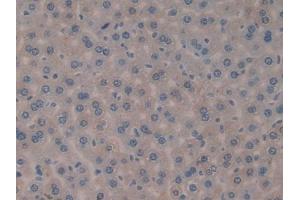 DAB staining on IHC-P; Samples: Mouse Liver Tissue (FIL1d 抗体  (AA 1-156))