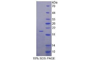 SDS-PAGE analysis of Human MAP1LC3a Protein. (MAP1LC3A 蛋白)