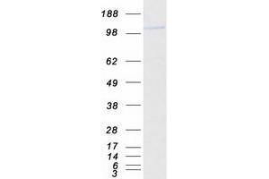 Western Blotting (WB) image for Coiled-Coil and C2 Domain Containing 1B (CC2D1B) protein (Myc-DYKDDDDK Tag) (ABIN2713270)