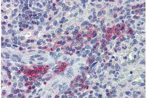 Immunohistochemistry staining of human spleen (paraffin sections) with anti-LIME polyclonal antibody. (LIME 抗体  (AA 141-295))