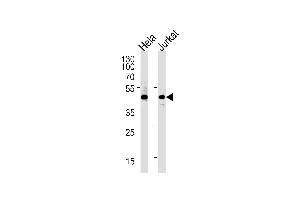 Western blot analysis of lysates from Hela,Jurkat cell line (from left to right),using PTGDR Antibody (ABIN486691 and ABIN1536072). (PTGDR 抗体)