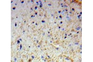 Used in DAB staining on fromalin fixed paraffin-embedded Brain tissue (OTUB1 抗体  (AA 1-271))