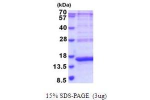 SDS-PAGE (SDS) image for Carcinoembryonic Antigen-Related Cell Adhesion Molecule 3 (CEACAM3) (AA 35-155) protein (His tag) (ABIN5853992) (CEACAM3 Protein (AA 35-155) (His tag))