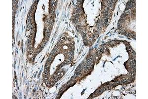 Immunohistochemical staining of paraffin-embedded liver tissue using anti-PRKAR2A mouse monoclonal antibody. (PRKAR2A 抗体)
