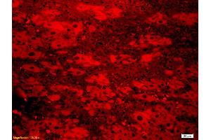 Formalin-fixed and paraffin embedded rat liver labeled with Anti-EGFP Polyclonal Antibody, Unconjugated (ABIN678503) at 1:300 followed by conjugation to the secondary antibody (eGFP 抗体  (AA 1-238))