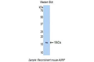 Western Blotting (WB) image for anti-Agouti Related Protein Homolog (Mouse) (AGRP) (AA 21-131) antibody (ABIN1174459)