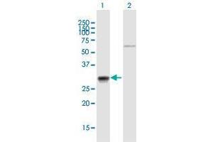 Western Blot analysis of CA7 expression in transfected 293T cell line by CA7 MaxPab polyclonal antibody. (CA7 抗体  (AA 1-264))
