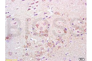 Formalin-fixed and paraffin embedded rat lung tissue labeled with Anti-Synaptotagmin 1/SYT1 Polyclonal Antibody, Unconjugated (ABIN754888) at 1:200 followed by conjugation to the secondary antibody, (SP-0023), and DAB staining (Synaptotagmin 抗体  (AA 165-260))