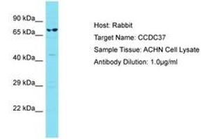 Image no. 1 for anti-Coiled-Coil Domain Containing 37 (CCDC37) (AA 528-577) antibody (ABIN6750799) (CCDC37 抗体  (AA 528-577))