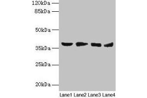 Western blot All lanes: AKR1C2 antibody at 14 μg/mL Lane 1: HepG2 whole cell lysate Lane 2: MCF-7 whole cell lysate Lane 3: Hela whole cell lysate Lane 4: Rat liver tissue Secondary Goat polyclonal to rabbit IgG at 1/10000 dilution Predicted band size: 37, 16 kDa Observed band size: 37 kDa (AKR1C2 抗体  (AA 1-323))