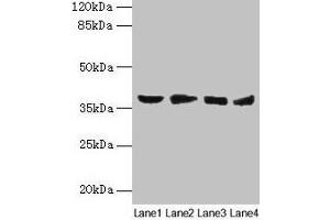 Western blot All lanes: AKR1C2 antibody at 14 μg/mL Lane 1: HepG2 whole cell lysate Lane 2: MCF-7 whole cell lysate Lane 3: Hela whole cell lysate Lane 4: Rat liver tissue Secondary Goat polyclonal to rabbit IgG at 1/10000 dilution Predicted band size: 37, 16 kDa Observed band size: 37 kDa