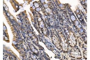 ABIN7094592 and ABIN7098641 at 1/100 staining Mouse colorectal tissue by IHC-P. (SSH1 抗体  (C-Term))