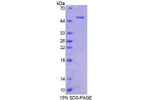 SDS-PAGE analysis of Human CBLN1 Protein. (CBLN1 蛋白)