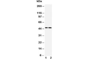 Western blot testing of Caspase-2 antibody and Lane 1:  CEM;  2: SMMC-7721 cell lysate (Caspase 2 抗体  (AA 417-439))