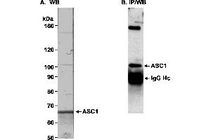 Immunoprecipitation (IP) image for anti-Thyroid Hormone Receptor Interactor 4 (TRIP4) (AA 75-125) antibody (ABIN7449573) (TRIP4 抗体  (AA 75-125))