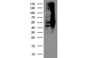 Image no. 1 for anti-Dihydrolipoamide Dehydrogenase (DLD) antibody (ABIN1497849) (DLD 抗体)