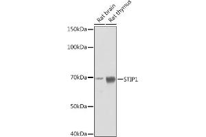 Western blot analysis of extracts of various cell lines, using STIP1 Rabbit mAb (ABIN1512566, ABIN3020619, ABIN3020620 and ABIN7101303) at 1:1000 dilution. (STIP1 抗体)