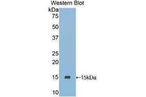 Western blot analysis of the recombinant protein. (SLURP1 抗体  (AA 1-103))