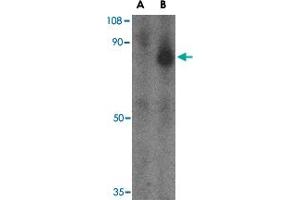 Western blot analysis of FEZ1 in SK-N-SH cell lysate with FEZ1 polyclonal antibody  at 1 ug/mL in the (A) presence and (B) absence of blocking peptide. (FEZ1 抗体  (C-Term))