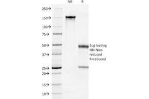 SDS-PAGE Analysis Purified Cytokeratin 7 Mouse Monoclonal Antibody (OV-TL12/30). (Cytokeratin 7 抗体)