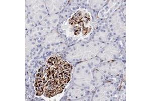 Immunohistochemical staining of human kidney with PRX polyclonal antibody  shows strong cytoplasmic and nuclear positivity in cells in glomeruli at 1:200-1:500 dilution. (Periaxin 抗体)