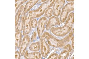 Immunohistochemistry of paraffin-embedded rat kidney using SARA Rabbit mAb (ABIN7271559) at dilution of 1:50 (40x lens). (ZFYVE9 抗体)