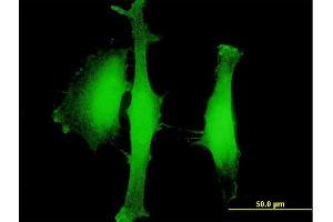 Immunofluorescence of purified MaxPab antibody to AGBL5 on HeLa cell. (AGBL5 抗体  (AA 1-724))