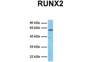 Host:  Rabbit  Target Name:  RUNX2  Sample Tissue:  Human Jurkat  Antibody Dilution:  1. (RUNX2 抗体  (Middle Region))