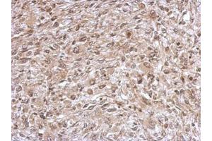 IHC-P Image Immunohistochemical analysis of paraffin-embedded C2C12 xenograft, using TrxR1, antibody at 1:500 dilution. (TXNRD1 抗体)