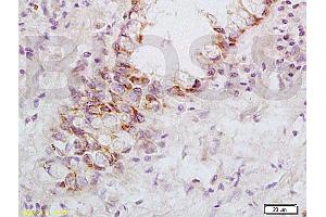 Immunohistochemistry (IHC) image for anti-Fas Ligand (TNF Superfamily, Member 6) (FASL) (AA 196-281) antibody (ABIN726410)