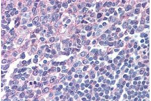 Human Tonsil (Formalin-Fixed Paraffin-Embed) stained with IRF8 antibody ABIN305734 at 5 ug/ml followed by biotinylated anti-goat IgG secondary antibody ABIN481715, alkaline phosphatase-streptavidin and chromogen. (IRF8 抗体  (AA 414-426))
