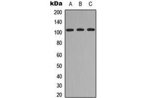 Western blot analysis of ITIH4 70k expression in HEK293T (A), Raw264. (ITIH4 70k (Center) 抗体)