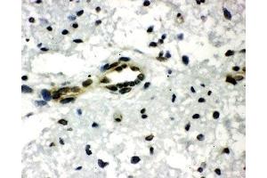 Immunohistochemistry (IHC) image for anti-C-terminal Binding Protein 1 (CTBP1) (AA 425-440) antibody (ABIN3030237)